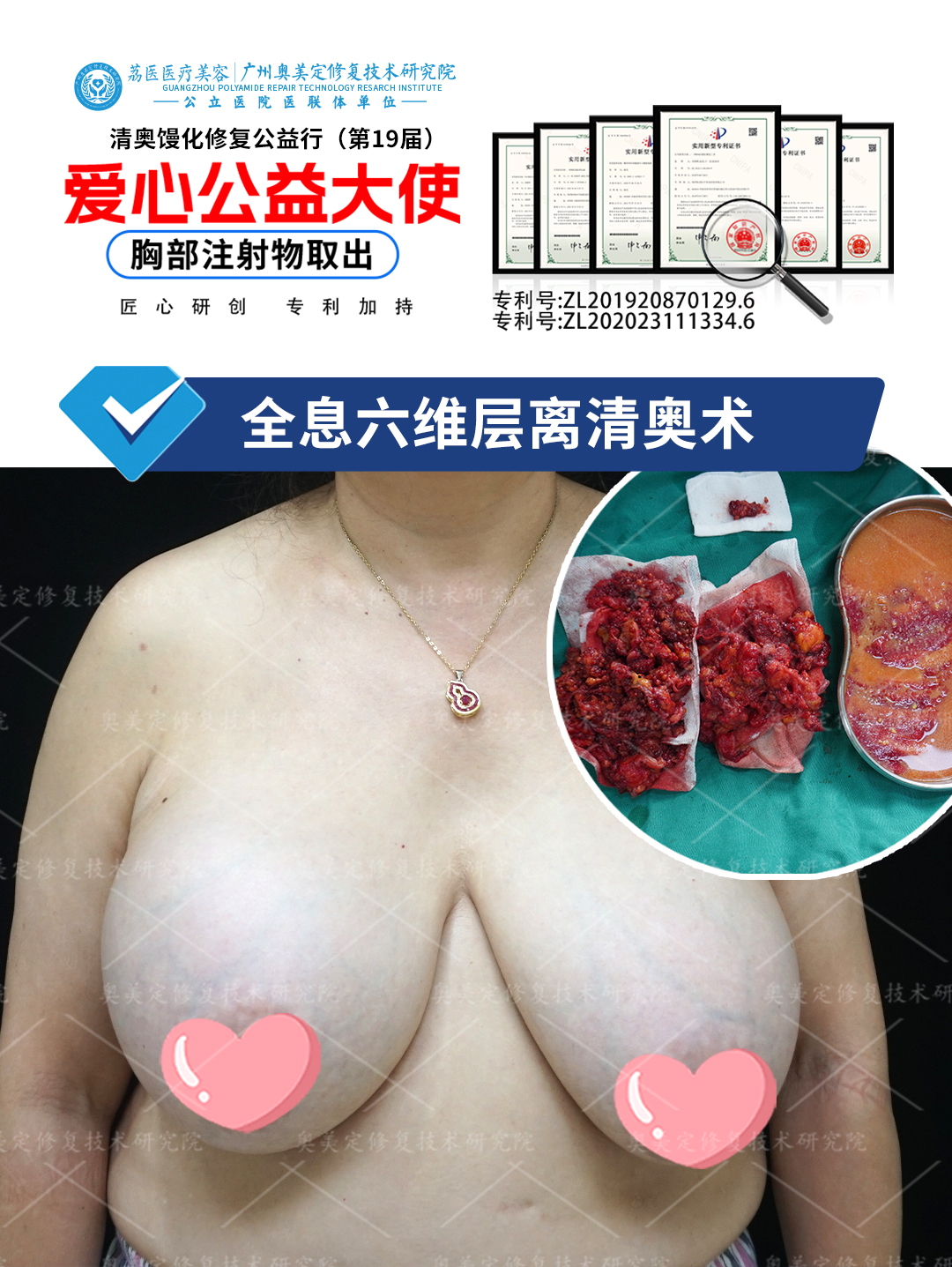 捷克水分子怎么取