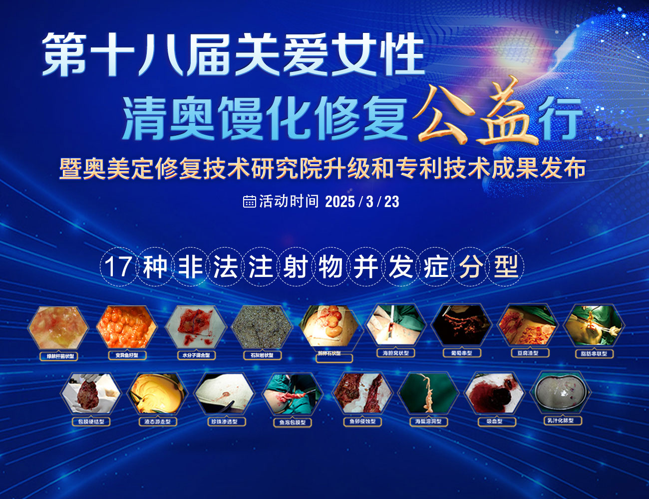 奥美定丰太阳穴后还可以取出吗