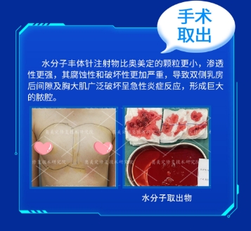 关于“捷克水分子取出”，你需要知道的副作用真相