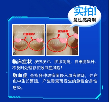 一位求美者的血泪自白：小吴在黑诊所经历的"捷克水分子"噩梦